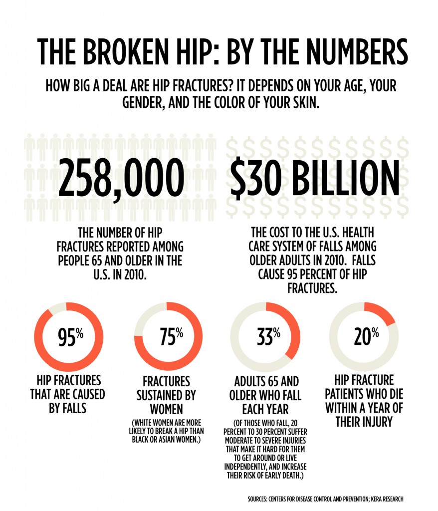 hip_fractures_graphic